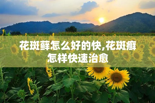 花斑藓怎么好的快,花斑癣怎样快速治愈