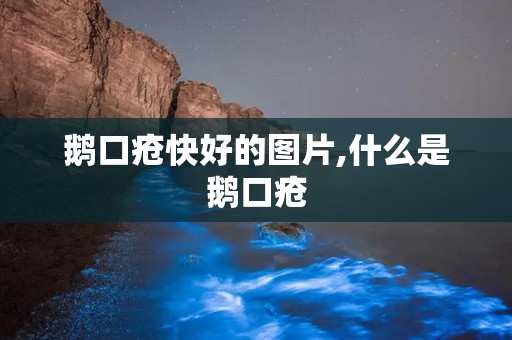 鹅口疮快好的图片,什么是鹅口疮