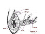 阴道洗涤器：女性健康新宠，让私处更清爽